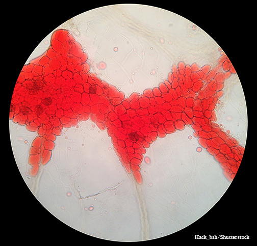 fat cells under a microscope